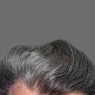 موهای سفید یا خاکستری